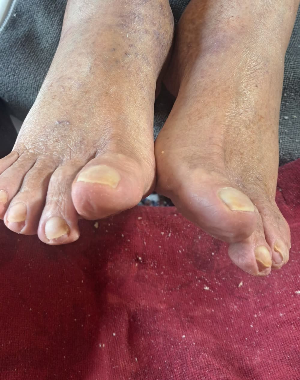 Les mêmes pieds après un soin complet