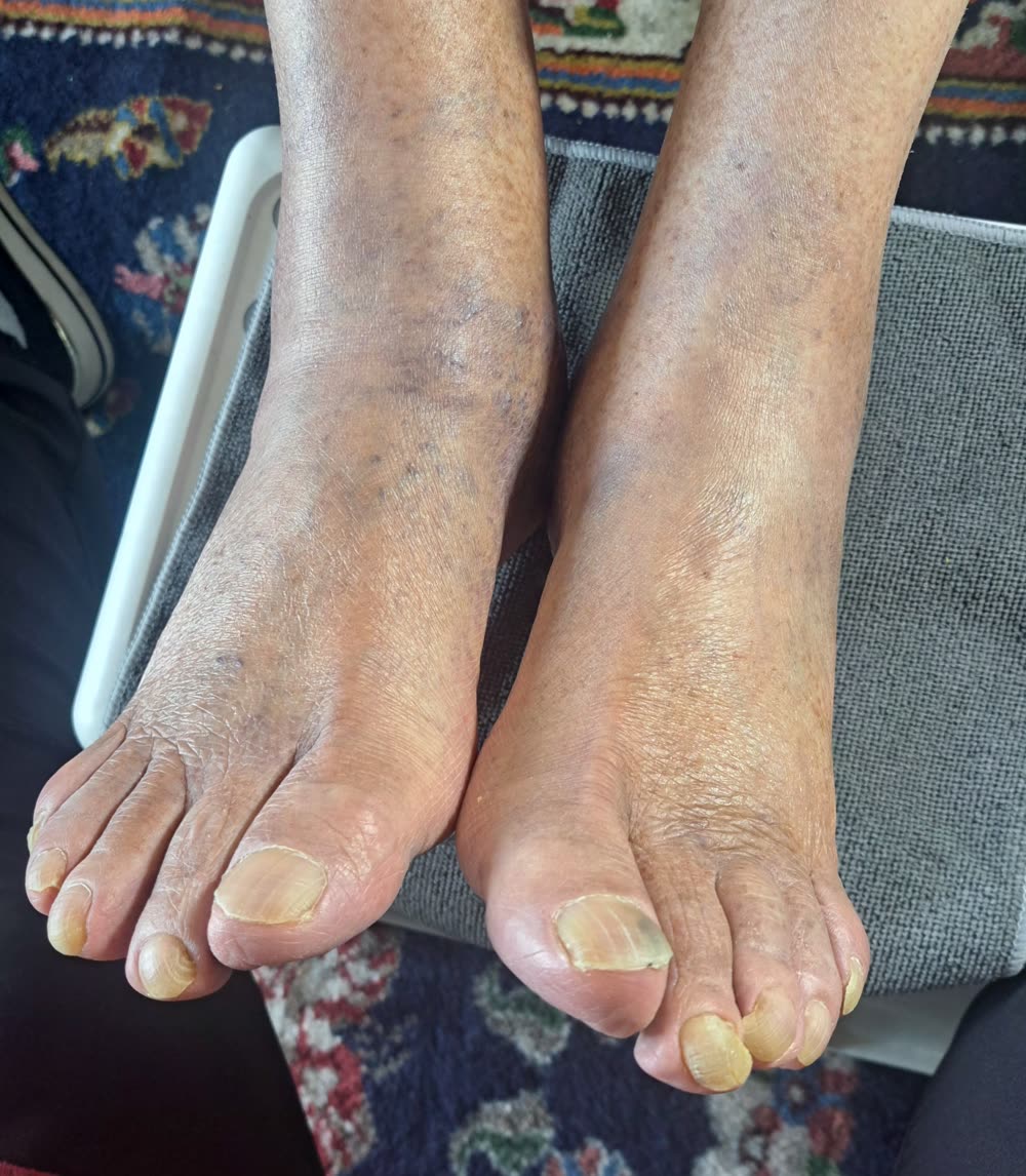 Pieds avant un soin complet